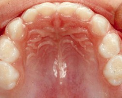 DENTICIÓN